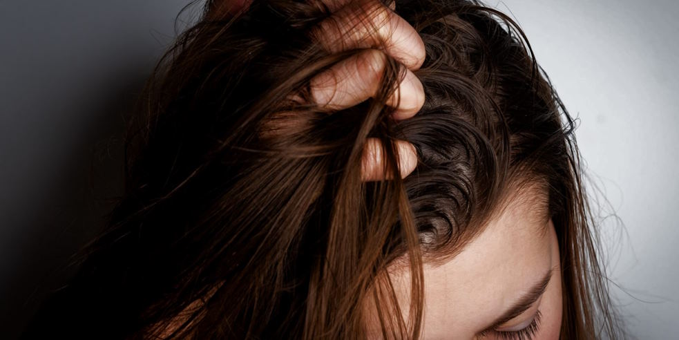 Managing Oily Hair: Ways for Controlling Excess Scalp Oil